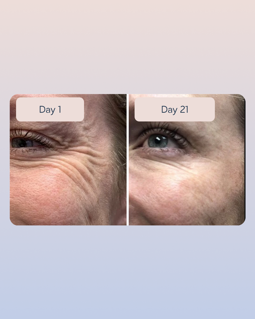 Golden Retinol Eye Cream