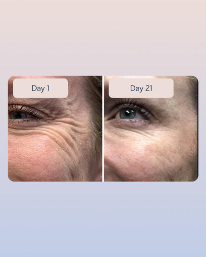 Golden Retinol Eye Cream