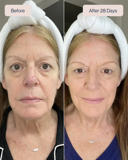 Swiss Niacinamide Serum